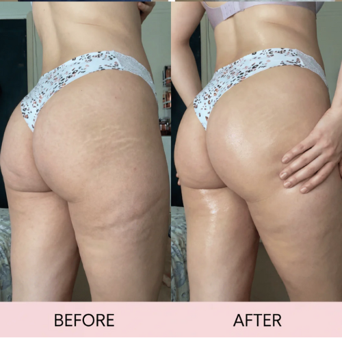 Cellulite massage oil